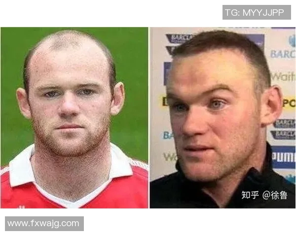 足球明星秃头扎辫子引发热议网友热评不断视频背后故事揭秘